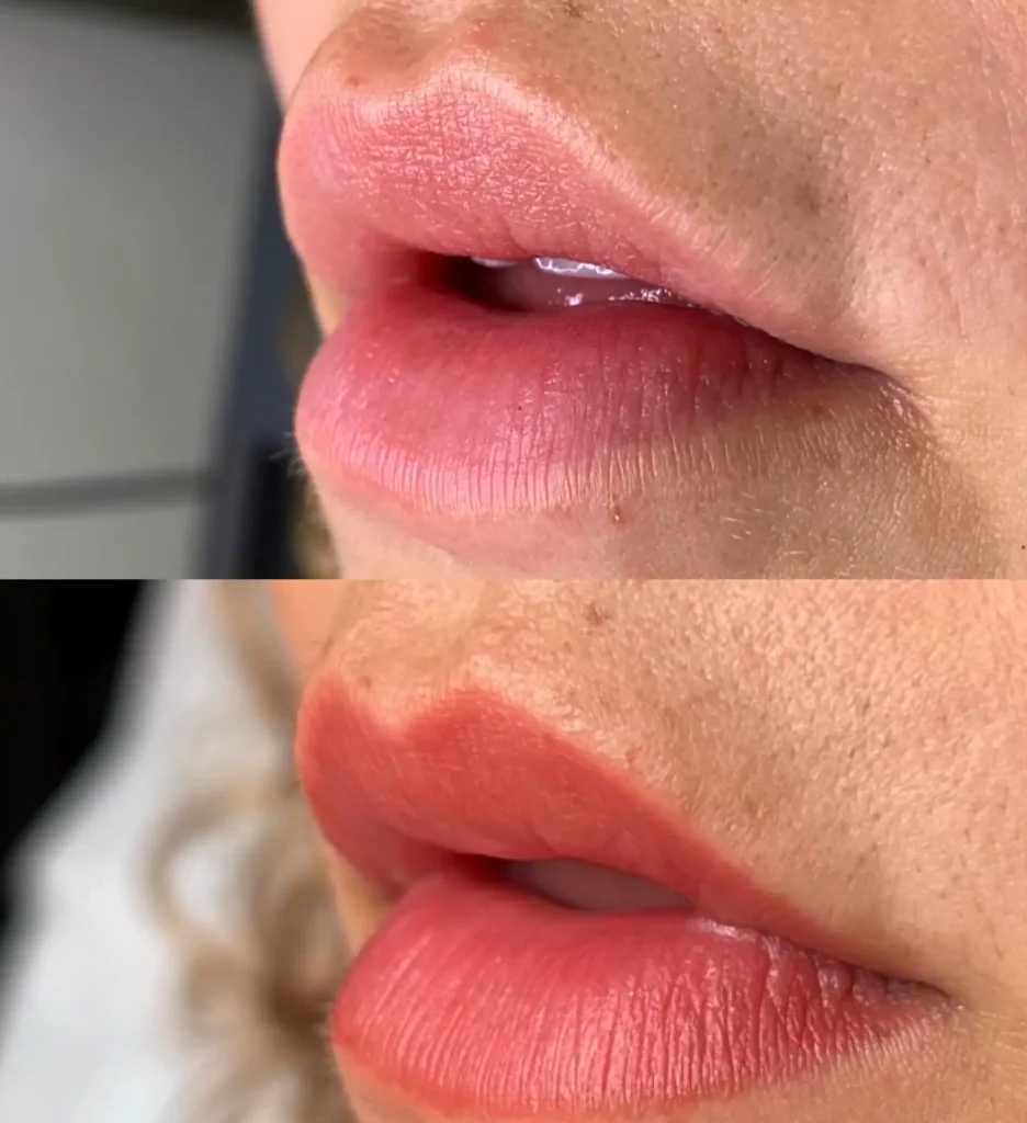 Melbourne cosmetic lip tattooing