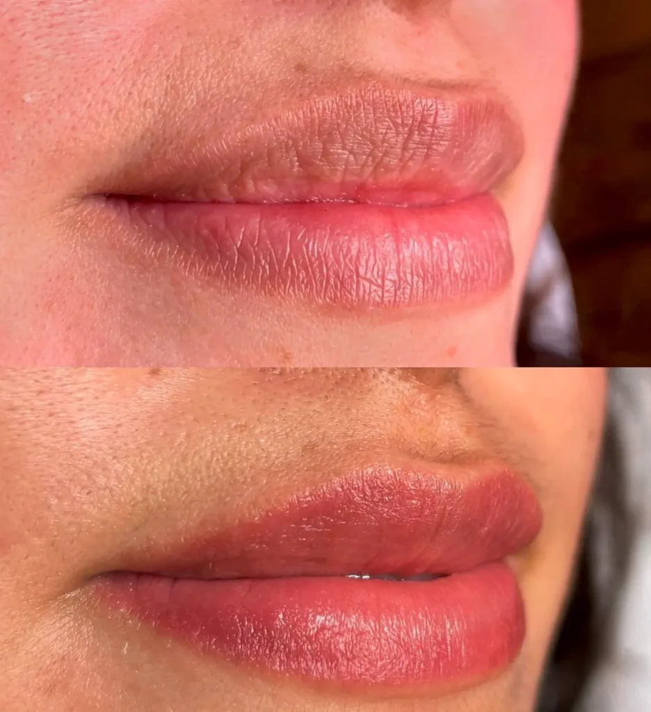 Melbourne cosmetic lip tattooing