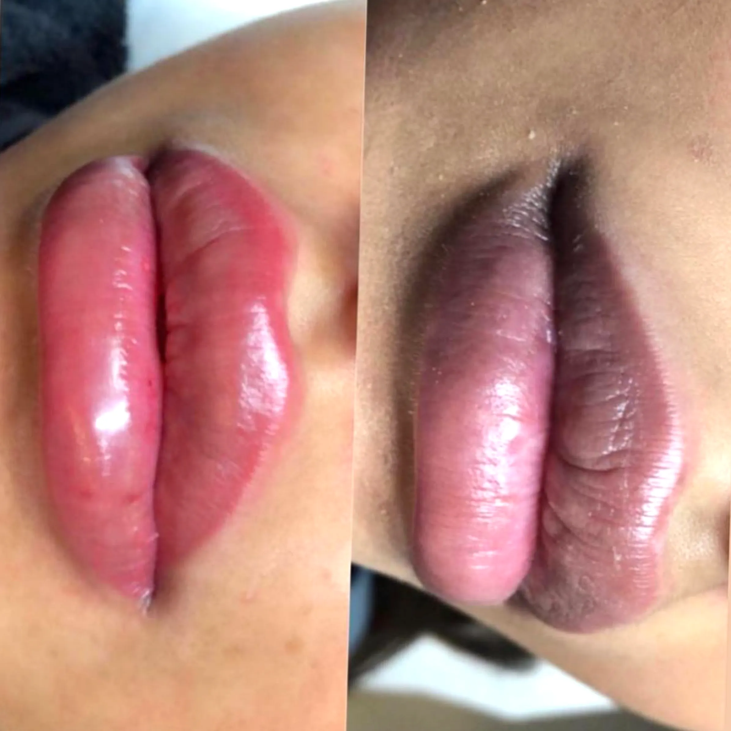 lip tattoo infection risk